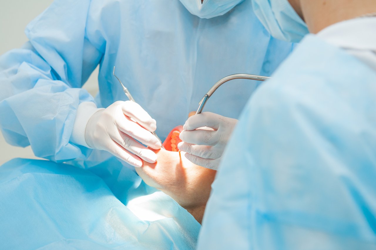 Dental Flap Surgery